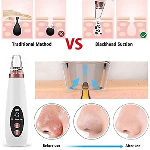 GLENOXZONE Skin Scrubber Exfoliator Facial Cleansing Brush Blackhead Whitehead Extractor Remover Device Acne Pimple Pore Cleaner Vacuum Suction Tool Massager For MenWomen Pore Cleaner Vacuum - Image 4
