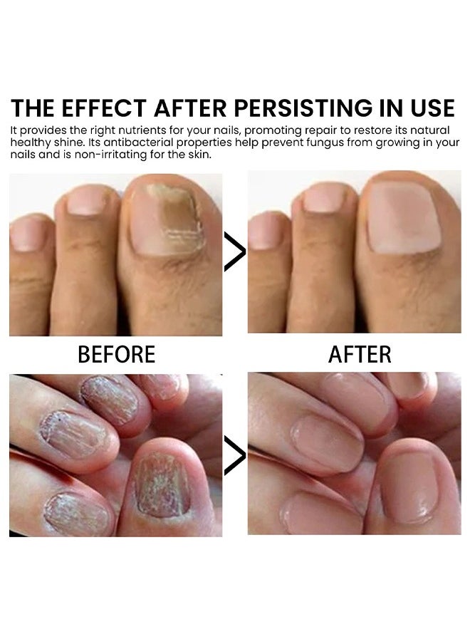 West&Month Nails Strengthen Cuticle Oil for Repair Onychomycosis,Strengthen Nail Cuticles,Care for Nails, Moisturizes and Brightens Nails, 15 ml  - Image 5