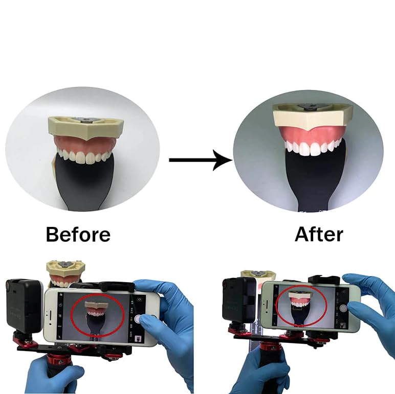 Impressive Smile Dental Photography Aid, Oral Cell Phone Camera Fill Light Brightness Led Video Light Studio Lighting Kit for Home, Salon, Hospital - Image 5
