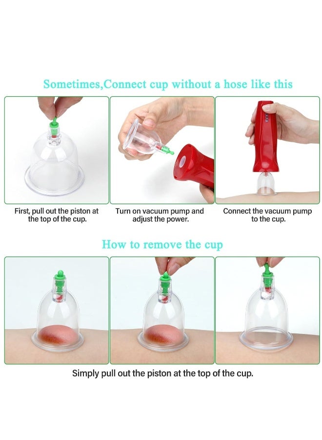 Loquat Cupping Therapy Set Professional Electric Kit for Massage with 4 Levels and Charging Cable, 6 Additional Cups  Extended Hose for Back Pain Relief Muscle Relaxation - Image 5