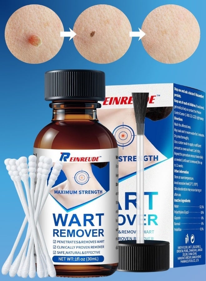 REINREUDE سيروم إزالة الثآليل 30 مل مكونات عشبية علاج آمن للثآليل على الجسم لعلاج حب الشباب والشامات والندبات - Image 1