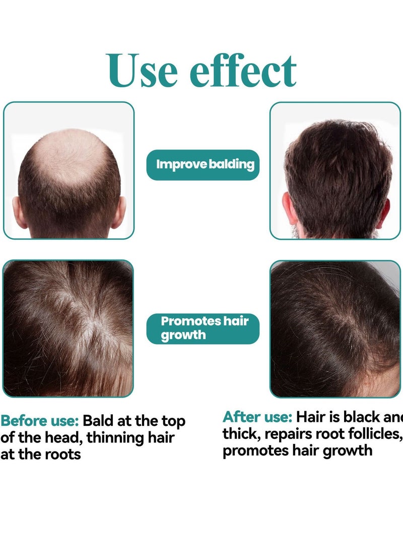 EELHOE - Hair Growth Serum - Biotin Hair Regrowth Oil Prevent Hair Loss and Helps Hair Thicker, Stronger, Longer Hair Treatment Men and Women (45 mL) - Image 1