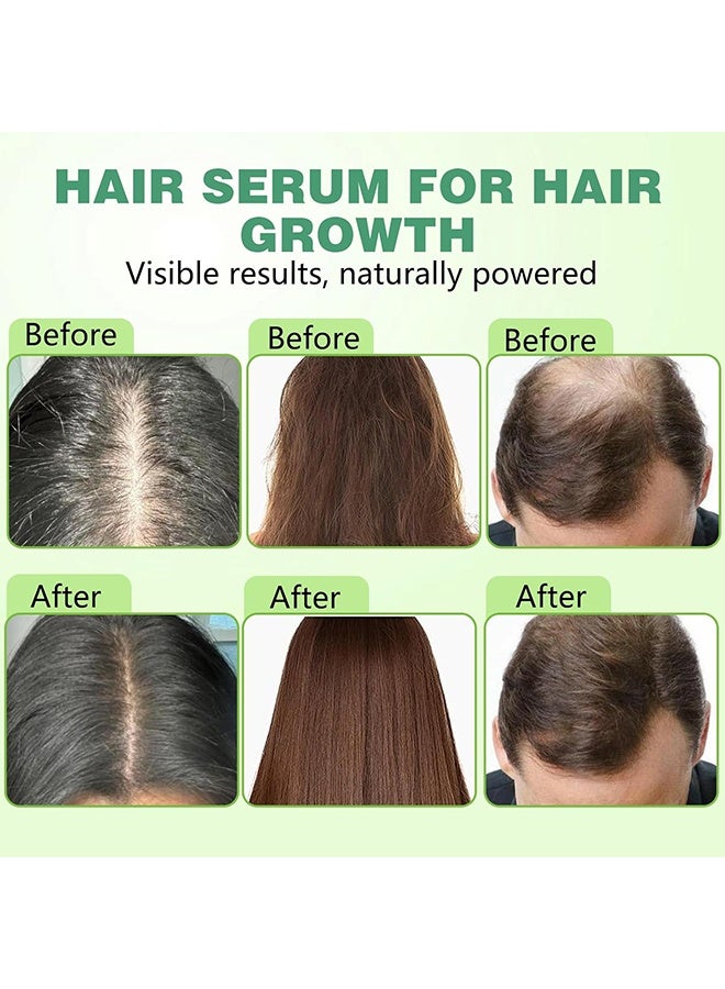 Googeer Microneedle Hair, Hair Regrowth System, Alphainfuse Hair Regrowth System, Advanced Hair Growth Treatment Serum For Thicker, Fuller Hairs, Strengthens Roots, Gentle Painless, Supports Healthy Hairs Growth For Men & Women - Image 4