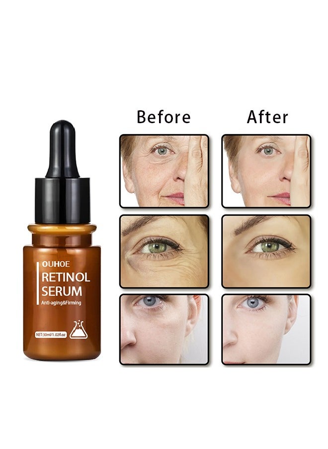OUHOE - Anti Aging & firming Retinol Serum , Vitamine E & Antioxidants Hyaluronic Acid Anti-Aging Serum, Reduces Wrinkles, Fine Lines, Age Spots, Sun Spots, Anti Wrinkle Facial Serum 30ml - Image 1