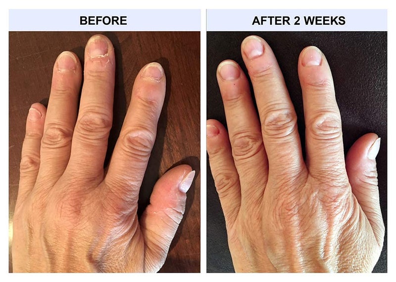 TIPS Nail Conditioner 3 Pack - Image 4