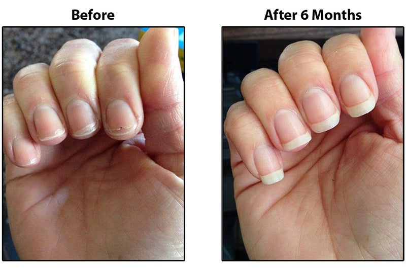 TIPS Nail Conditioner 3 Pack - Image 3