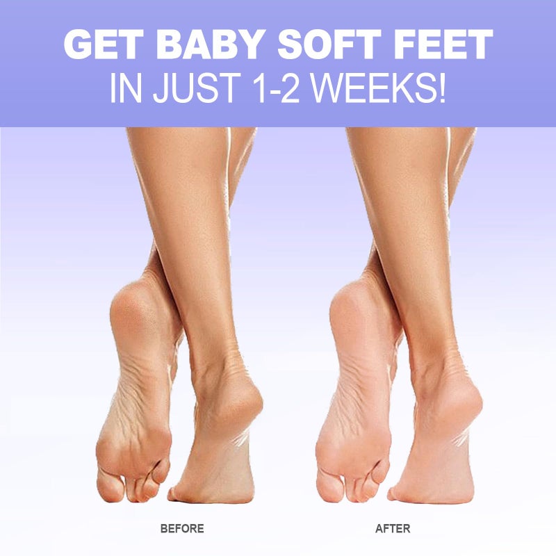 JVR Foot Peel Mask - 3 Pairs - Exfoliating Peeling Callus Remover, Repairs Cracked Heels & Dead, Dry Skin, for Smoother and Softer Feet (Lavender) - Image 2