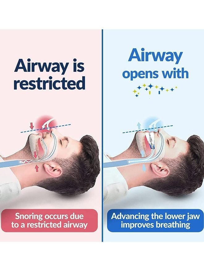Arabest - Anti-snoring Device Mouthpiece, Upgraded Adjustable Mouth Type Silicone Anti-snoring Device, Help Sleep at Night, Prevent Snoring and Snoring, Anti-grinding Braces Snoring Device (Standard Size) - Image 1