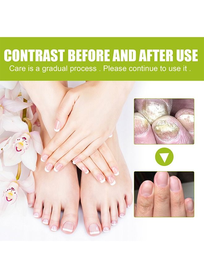 efero Nail Treatment Repairing Gel Nail Repairing Gel Eliminates 99.9% of Fungus & Bacterial Infections in Hand & Toe Nails Nail Damage Repair & for Healthy Nails for Men & Women 20g - Image 4