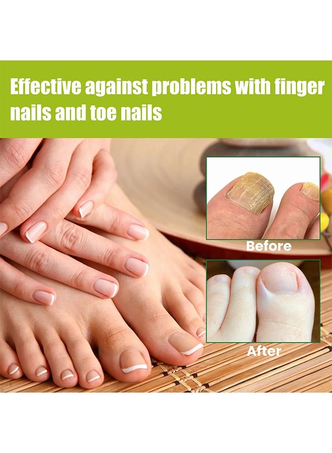 efero Nail Treatment Repairing Gel Nail Repairing Gel Eliminates 99.9% of Fungus & Bacterial Infections in Hand & Toe Nails Nail Damage Repair & for Healthy Nails for Men & Women 20g - Image 5