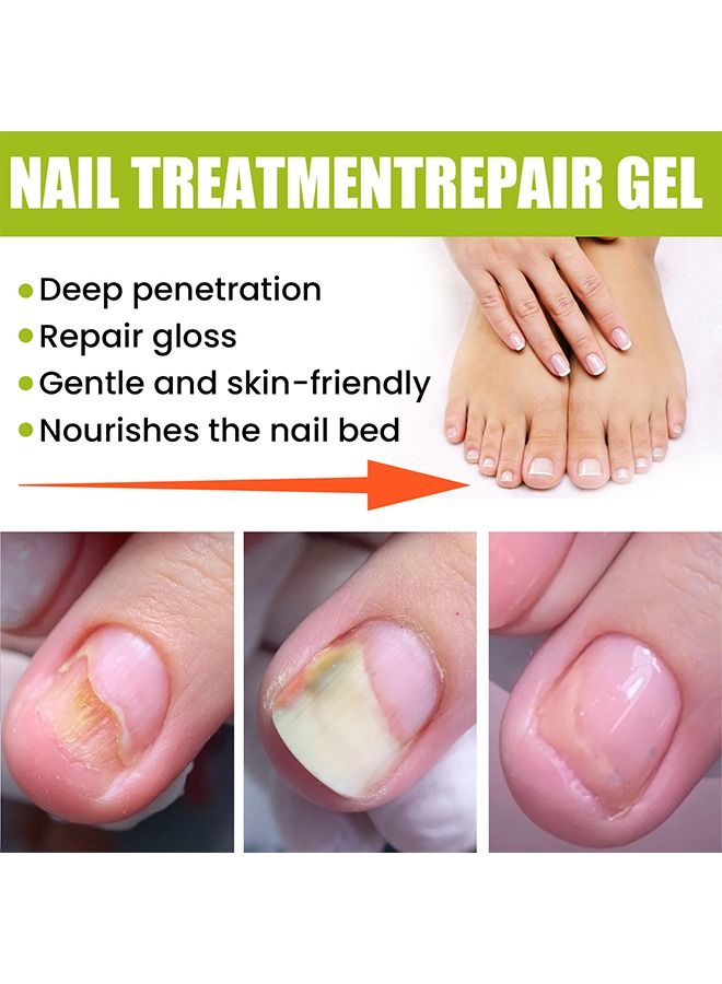 efero Nail Treatment Repairing Gel Nail Repairing Gel Eliminates 99.9% of Fungus & Bacterial Infections in Hand & Toe Nails Nail Damage Repair & for Healthy Nails for Men & Women 20g - Image 3