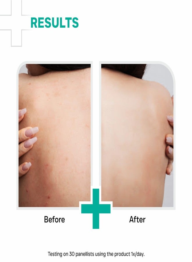 DERMATOUCH AHA 10% BHA 1% Body Lotion for Men & Women - Body lotion for dry skin - De-tans, Moisturizing & Bumpy Skin/Suitable for All Skin Types 100 ml - Image 4