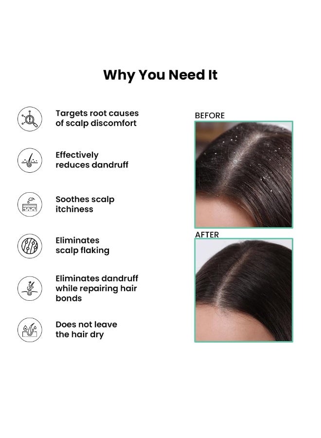 ThriveCo Scalp Clear Shampoo for Dandruff Control | Daily Use Shampoo With Zenscalpin™, Hyaplex™, Salicylic Acid | For Dandruff, Flaky & Itchy Scalp | For Men & Women | 250ml (250 ml) - Image 5