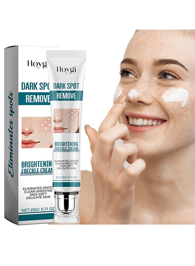 Hoygi Brightening Freckle Cream - Ultimate Brightening & Freckle Removal Cream - Powerful Whitening Cream for Age Spots, Dark Spots, and Skin Pigmentation | Fade Freckles, Chloasma, and Sun Spots for Even Skin Tone-20g - Image 1
