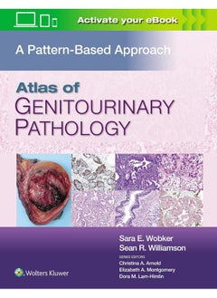 LWW Atlas of Genitourinary Pathology: A Pattern Based Approach  - Image 2