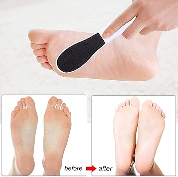 Rainmae Rainmae Foot Files for Hard Skin8 Packs DoubleSided Foot Rasp File and Callus Hard Skin Remover for Wet and Dry Cracked FeetWhite  - Image 4