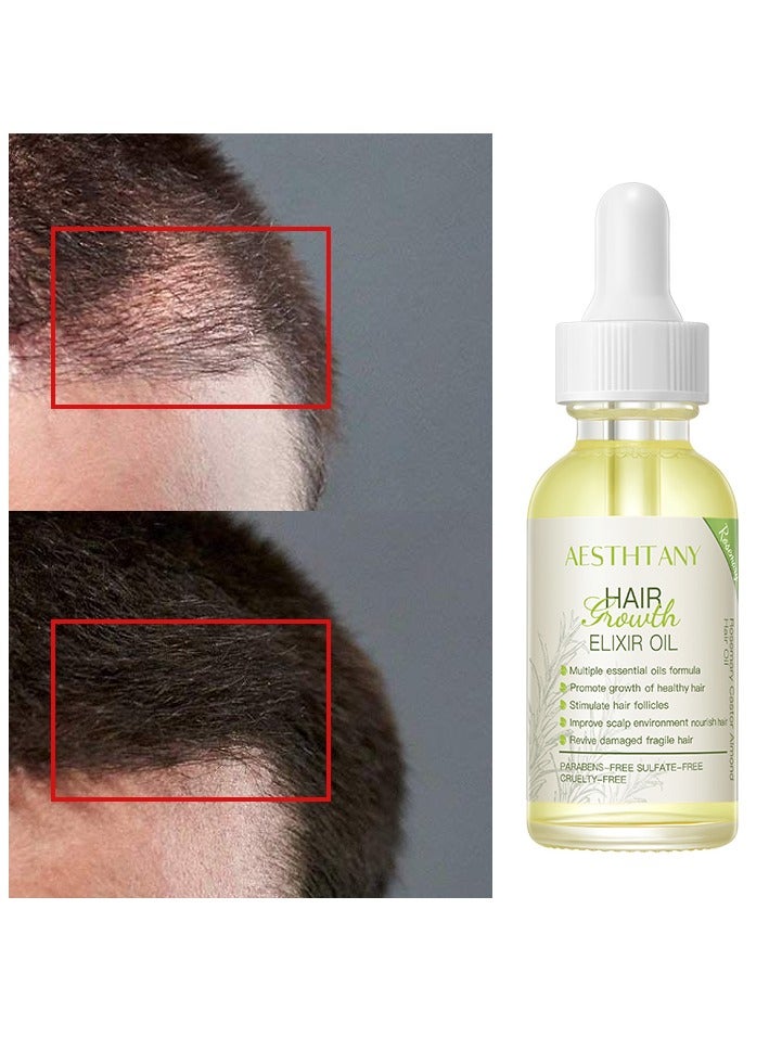Rosemary Hair Oil for Hair Growth, Scalp Health, and Frizzy Hair infused with Castor Oil & Almond Oil