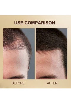 AESTHTANY Rosemary Hair Oil for Hair Growth, Scalp Health, and Frizzy Hair infused with Castor Oil & Almond Oil  - Image 4