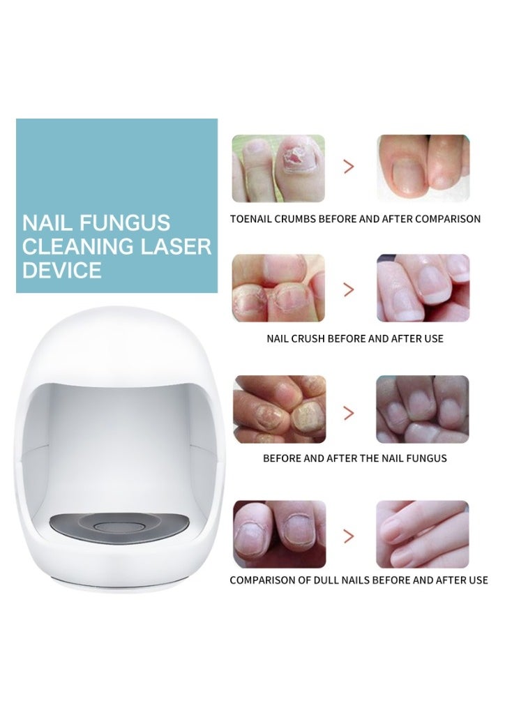 SOUTH MOON Nail Fungal Cleaning Laser Relief Device Toenails Paronychia Treatment Onychomycosis Care Device  - Image 3