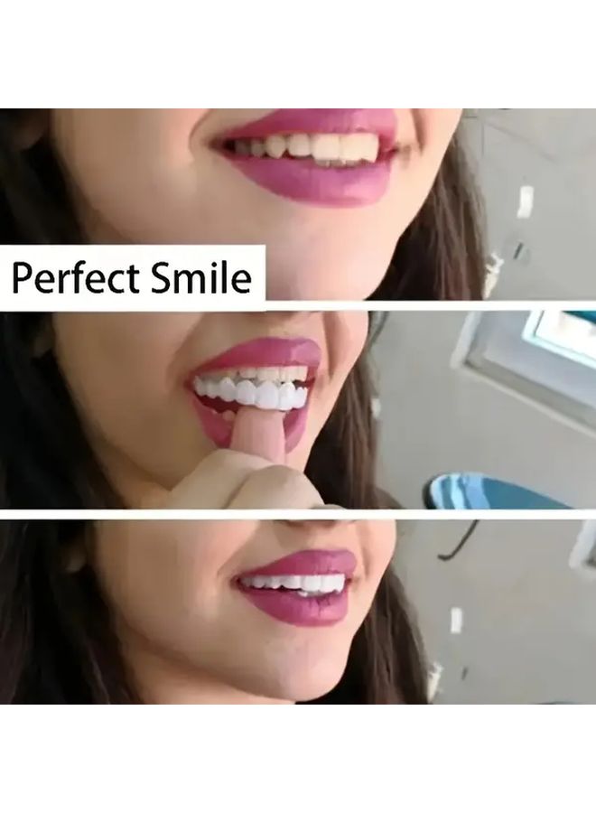 Soft Adjustable White Denture Veneer Set For Beautiful Smile - Image 2