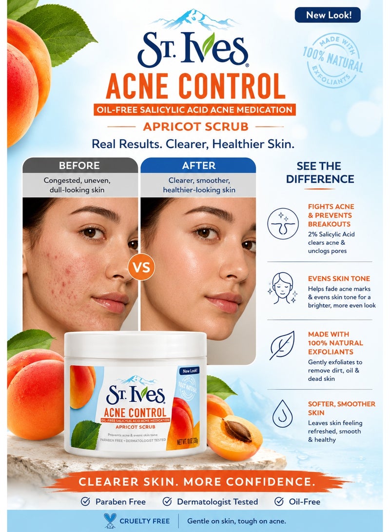 ST. Ives Acne Control Face Scrub 283g | 2% Salicylic Acid Acne Treatment | Deep Exfoliating Apricot Scrub for Oily & Acne-Prone Skin | Oil-Free - Image 3