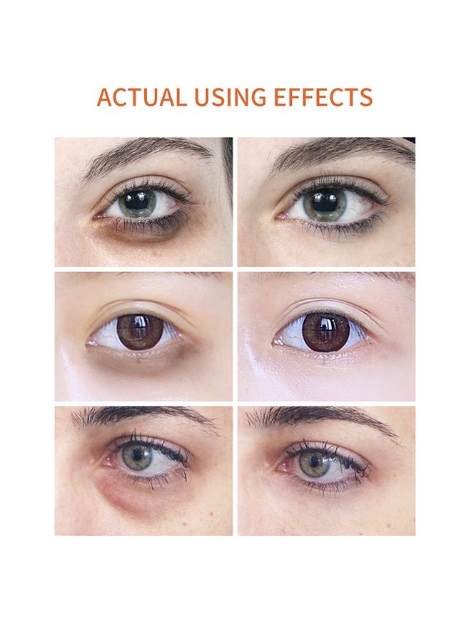 Breylee Vitamin C Eye Serum to tighten the skin under the eyes and remove dark circles with extract 15ml - Image 5