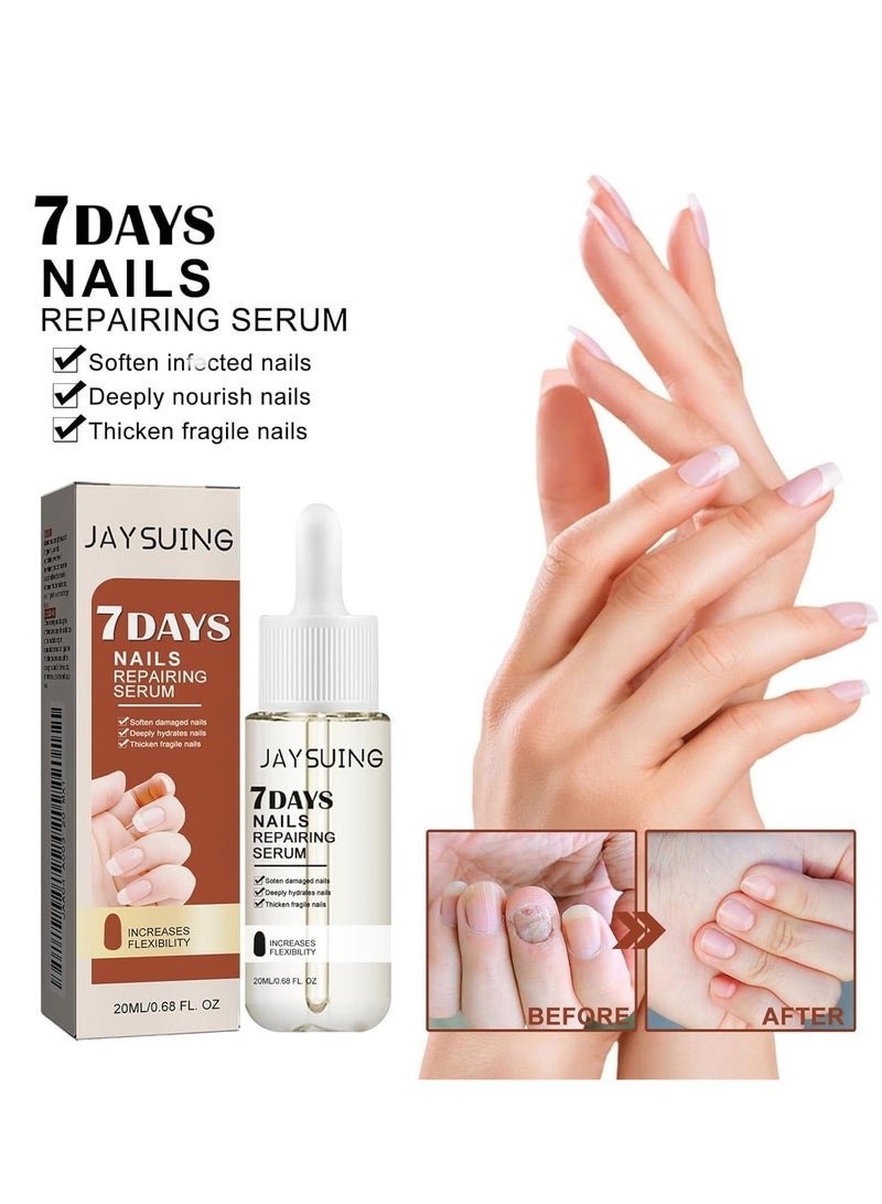 جايسوينغ مصل تقوية نمو الأظافر لمدة 7 أيام - 20 مل زيت إصلاح الأظافر للأظافر التالفة والهشة ، يعزز نمو الأظافر بشكل أسرع ويقوي الأظافر ، علاج شفاف - Image 2