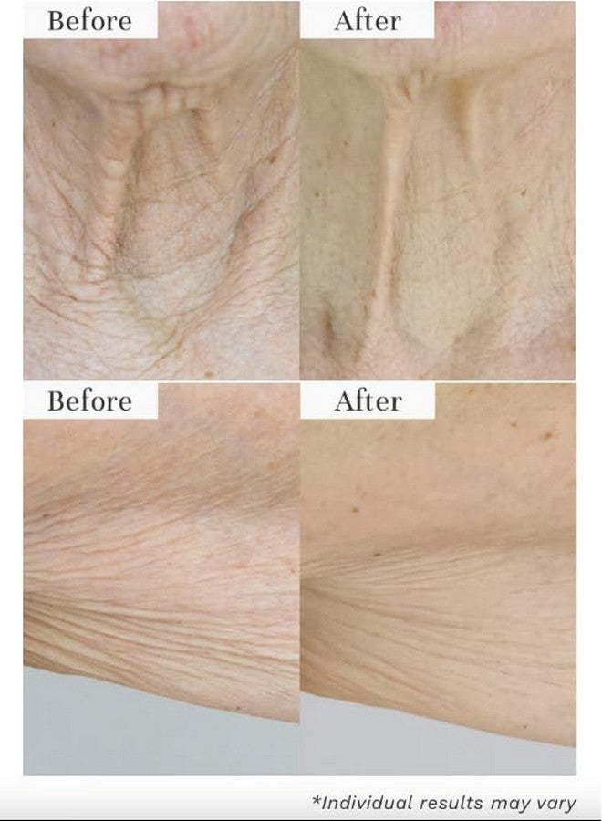 City Beauty Invisicrepe Body Balm - Skin Firming & Tightening Lotion For A Smoother, Firmer Look | Anti-Aging Firming Body Lotion & Body Cream - Image 2