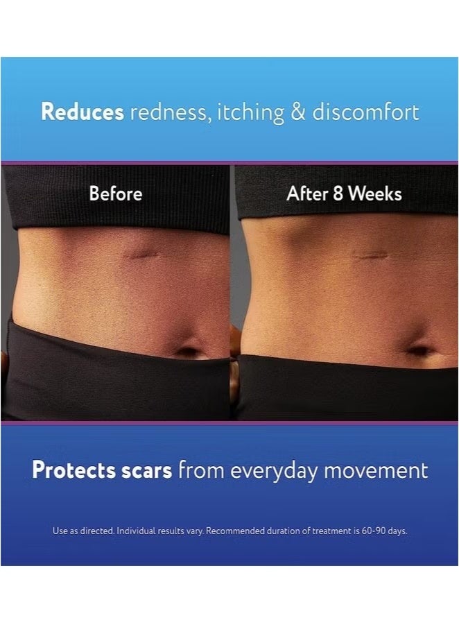 Kelo-cote Advanced Formula Scar Treatment Gel 15g, Helps Soften And Smooth Raised Scars, Maintaining The Moisture Balance of The Adjacent Skin, Reduces Discolouration, Redness, Pain and Discomfort of Scars - Image 4