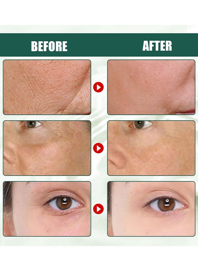 EELHOE Anti-Aging Daily Serum, Advanced Deep Anti Wrinkle Serum, Hyaluronic Acid Serum for Face, Anti-Aging Brightening Face Serum, Anti-Dark Spots and Brightening Serum, Firming, Plumping, Repair, Moisturizing 30ml  - Image 4