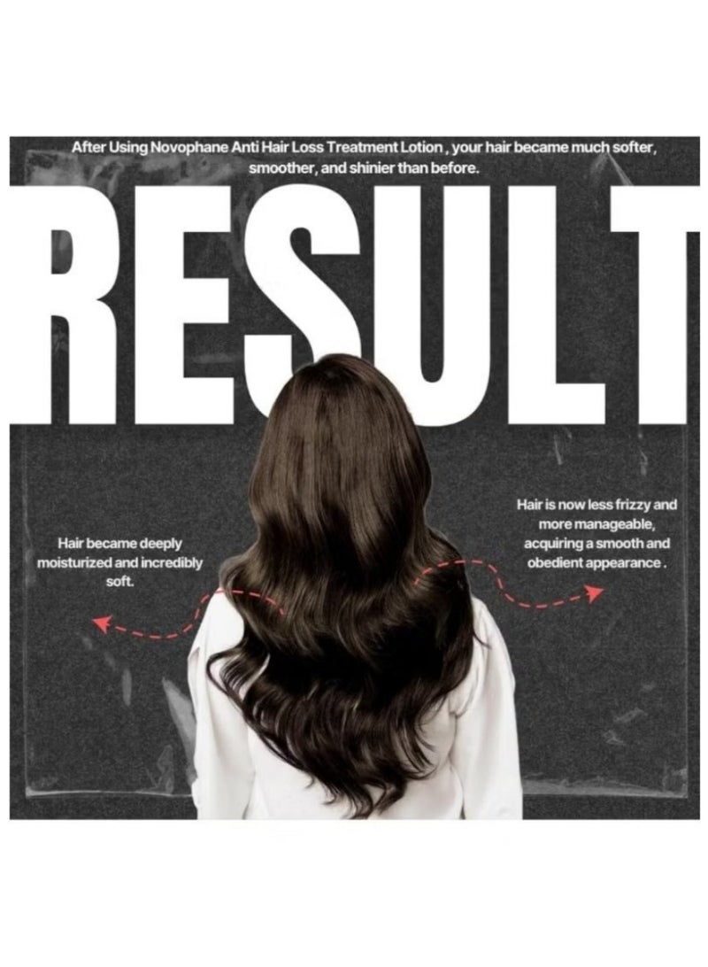 ACM Novophane Anti Hair Loss Lotion 100ml Strengthens Stimulates Hair Growth Leave In Scalp Treatment for Thinning Hair Men Women - Image 2