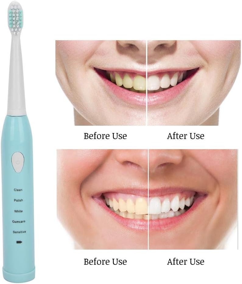 klarako Electric Toothbrushes for Adults, Ipx7 Waterproof Electric Sonic Toothbrush Electric Toothbrush Electric Sonic Toothbrushes Power for Sonic Whitening Sonic Toothbrush(Blue) - Image 4