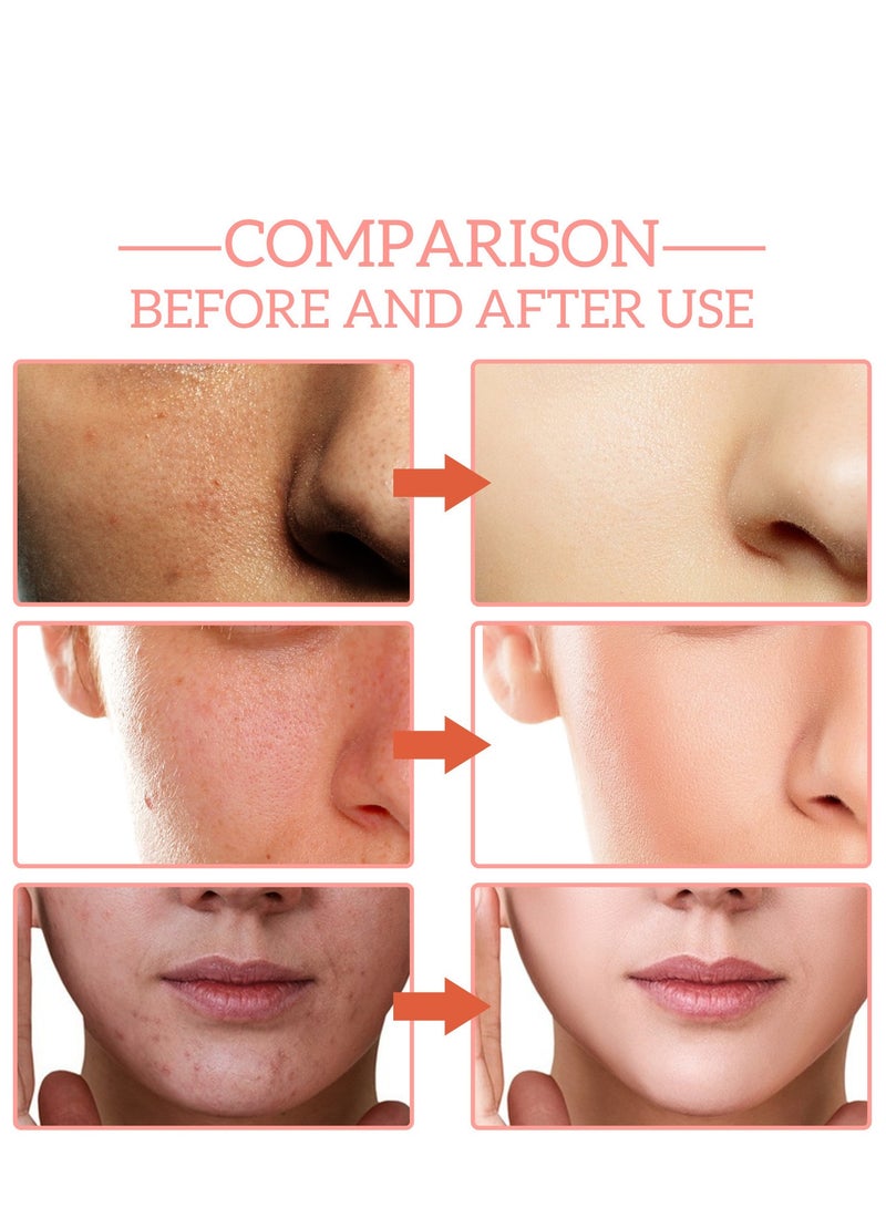 Jaysuing 5 In 1 Moisturizing Whitening Facial Serum, With Hyaluronic Acid Niacinamide Collagen Vitamin , Fast Absorbing Dark Spot Corrector Serum, Anti Wrinkles SerumFor Age Defying Beauty 30ml - Image 2