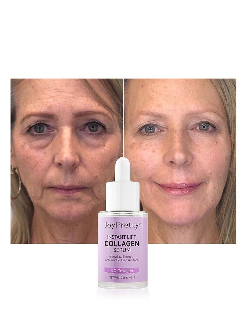 JoyPretty - Collagen Face Serum – Anti-Wrinkle & Moisturizing Treatment – Brightens Skin, Reduces Dark Spots & Fine Lines – 1.35 Fl Oz - Image 1