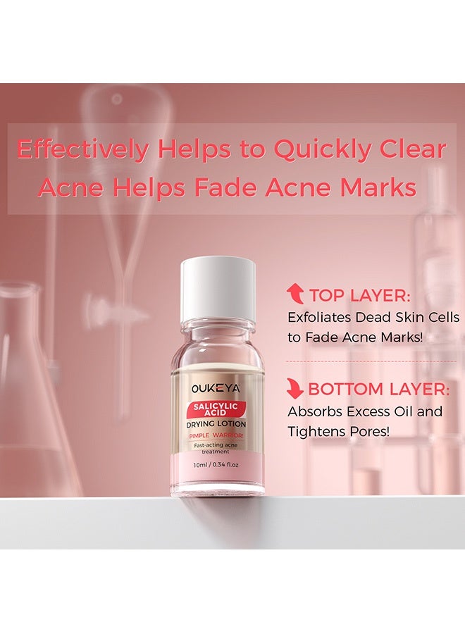OUKEYA Acne Drying Lotion with Salicylic Acid – Double Acid Formula for Acne-Prone Skin, Oil Control, Redness Relief, Fade Marks – 29ml - Image 4
