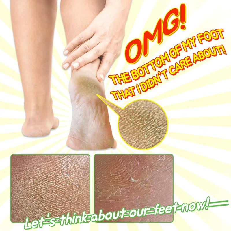 Elizavecca/Foot Peel /1 Foot Pack 2 Pairs Foot Mask - Boots for Exfoliating/foot pack review/foot pack before and after - Image 4
