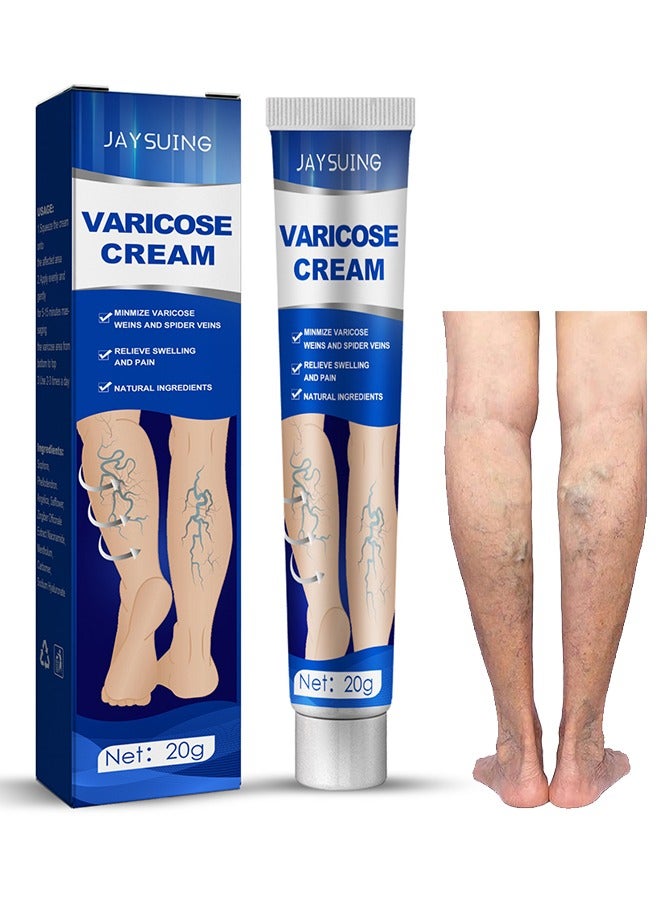 Jaysuing Varicose Veins Cream, Relief Phlebitis Angiitis 100% Natural Ingredients Added Eliminate The Appearance Of Varicose Veins - Vein Inflammation Treatment For Men And Women 20G - Image 1