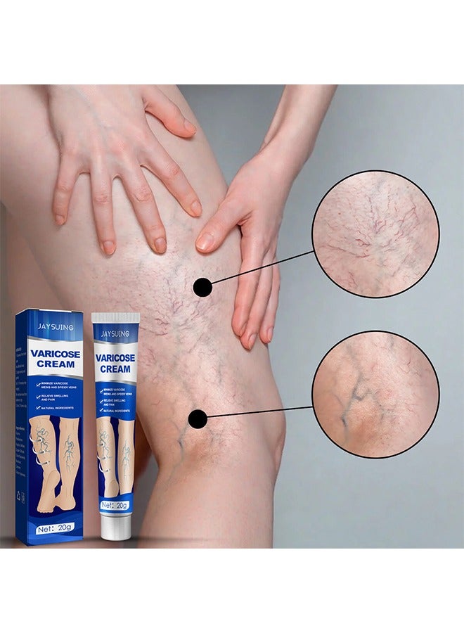 Jaysuing Varicose Veins Cream, Relief Phlebitis Angiitis 100% Natural Ingredients Added Eliminate The Appearance Of Varicose Veins - Vein Inflammation Treatment For Men And Women 20G - Image 3