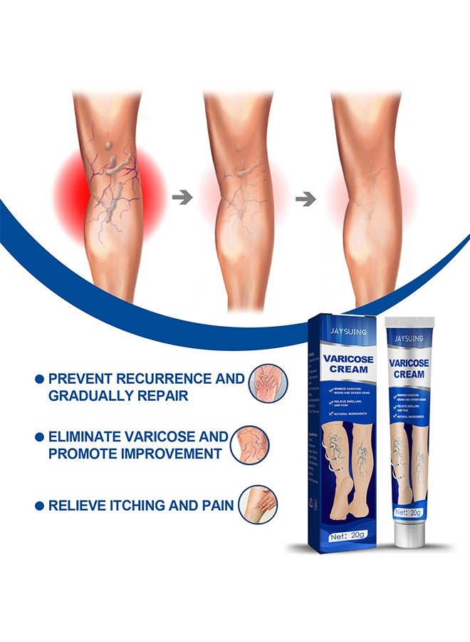 Jaysuing Varicose Veins Cream, Relief Phlebitis Angiitis 100% Natural Ingredients Added Eliminate The Appearance Of Varicose Veins - Vein Inflammation Treatment For Men And Women 20G - Image 5