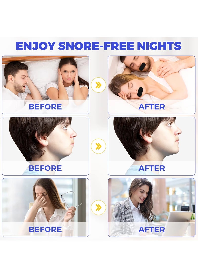 VOGSIG - 30 Patches Good Night Tape Mouth Tape Sleep Strips Soft and Comfortable Gentle and Secure Adhesive Sleep Mouth Tape Anti Snoring Less Mouth Breathing Odour Free Sleep Strips Mouth Tape - Image 1