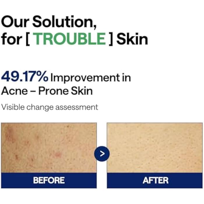 MEDIHEAL Teatree Trouble Pad - Square Cotton Facial Toner Pads with Tea Tree & Lactobacillus - Soothing to Calm Sensitive & Acne Prone Skin- Vegan Face Gauze 100 - Image 4