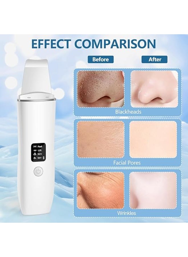 Ultrasonic Skin Scrubber & Facial Spatula - Rechargeable Blackhead Remover with 4 Modes - Deep Cleansing & Wrinkle Removal Tool - Image 3