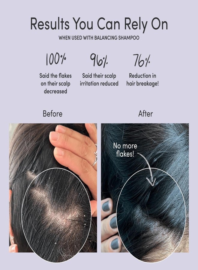 Jupiter, Dermatologist-Formulated Anti-Dandruff Shampoo, Conditioner, & Scalp Scrubber, for Women & Men, for Flaky, Itchy, Oily, & Dry Scalp, Vegan, Sulfate-Free, Color-Safe, & Paraben-Free, with Zinc - Image 3