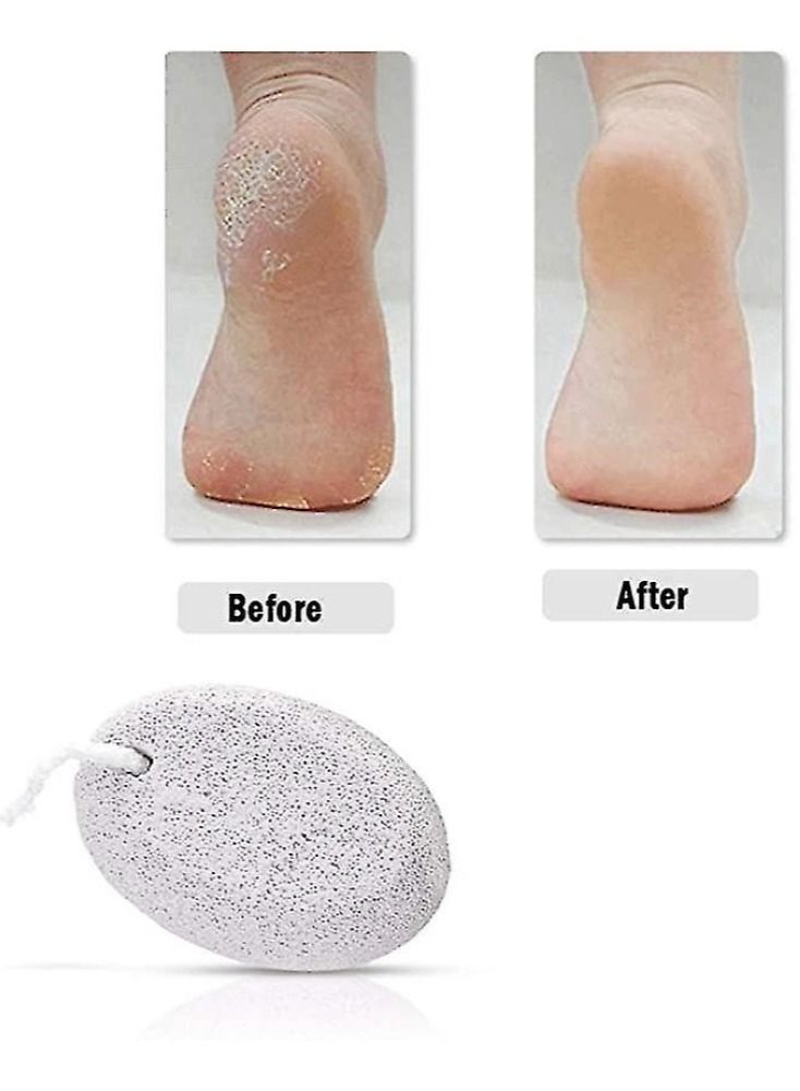 Natural Pumice Stone for Feet,2-Pack Lava Pedicure Tools Hard Skin Callus Remover for Feet and Hands - Natural Foot File Exfoliation to Remove Dead Skin, Heels, Elbows, Hands - Image 3