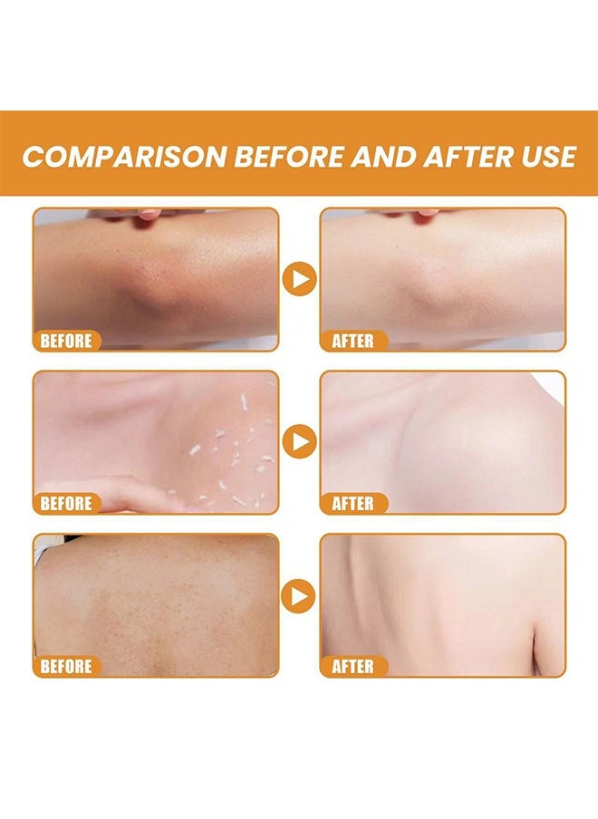 SOL LORA - Orange Exfoliating Whitening Gel,Deep Cleaning Gel ,For Face and Body Whitening 50g - Image 1