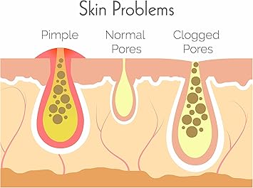 hit the spot شرائط تنظيف المسام للذقن والجبهة مع خلاصة البندق الساحر 6 قطع - Image 3