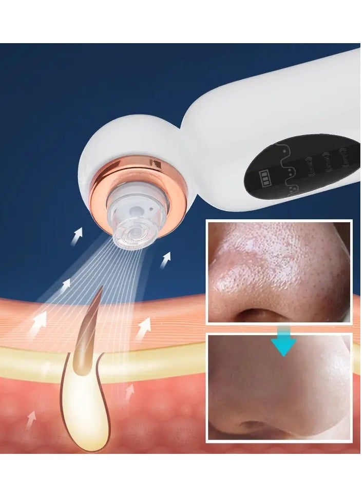 ORiTi USB Rechargeable Electric Bubble Blackhead Remover - Water Cycle Pore Acne Pimple Removal Vacuum Suction Facial Cleaner Tool - Image 4