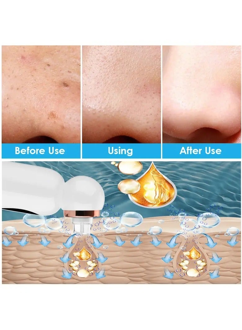 ORiTi USB Rechargeable Electric Bubble Blackhead Remover - Water Cycle Pore Acne Pimple Removal Vacuum Suction Facial Cleaner Tool - Image 5