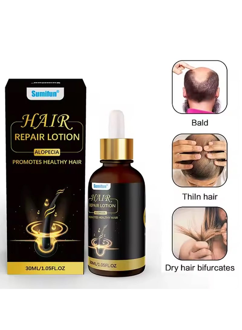 Sumifun Hair Repair Lotion, Hair Oil, Hair Loss Treatment, Moisturizing Anti Loss Hair Growth Essence, Promote Healthy Hair, Strengthen Hair Growth 30ml - Image 1