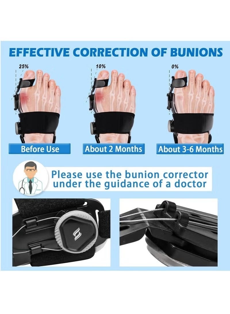 كيلا دعامة أصابع القدم، مصحح للبروز المفصلي، مقبض قابل للتعديل للرجال والنساء، للقدم اليمنى واليسرى، لتخفيف البروز المفصلي - Image 1